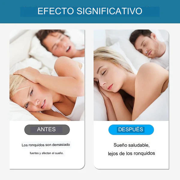 SleepEasy™ - Antironquidos Nasal