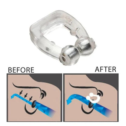 SleepEasy™ - Antironquidos Nasal