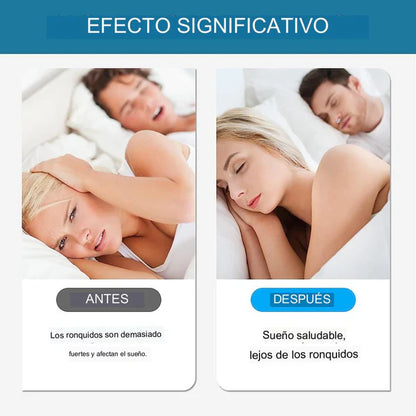 SleepEasy™ - Antironquidos Nasal